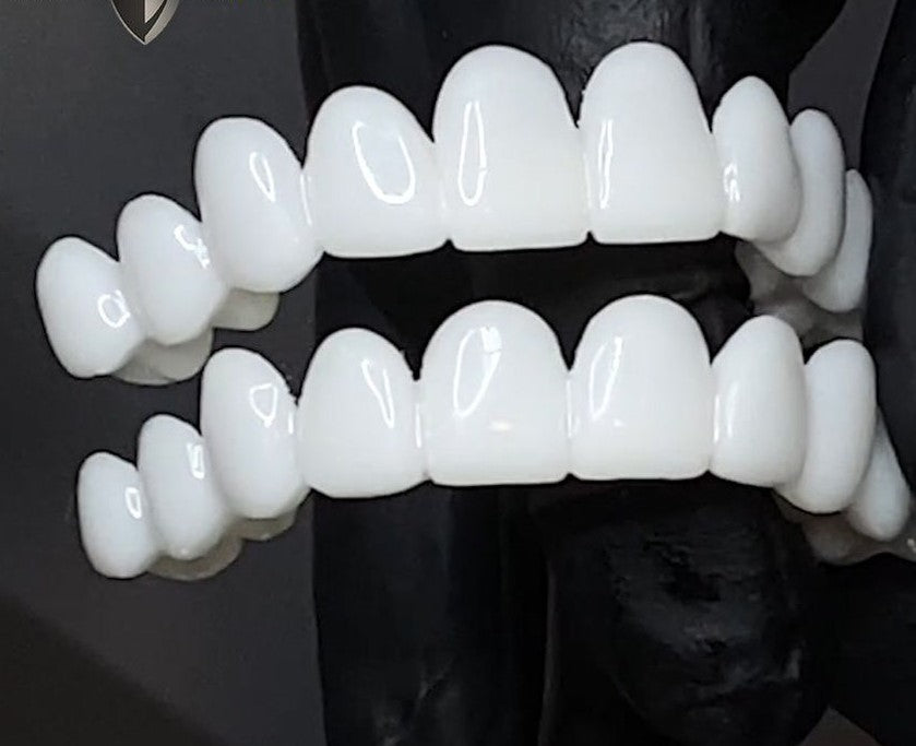 Orthorun | Snap-On Cosmetic Veneers – Instant Smile Cover for Imperfections