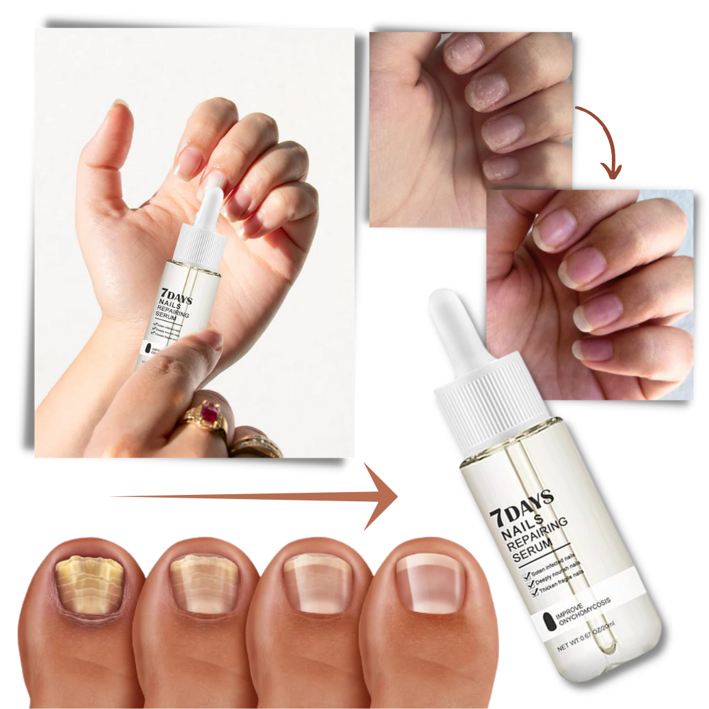 7 Days Nail Repair Essence - Orthorun