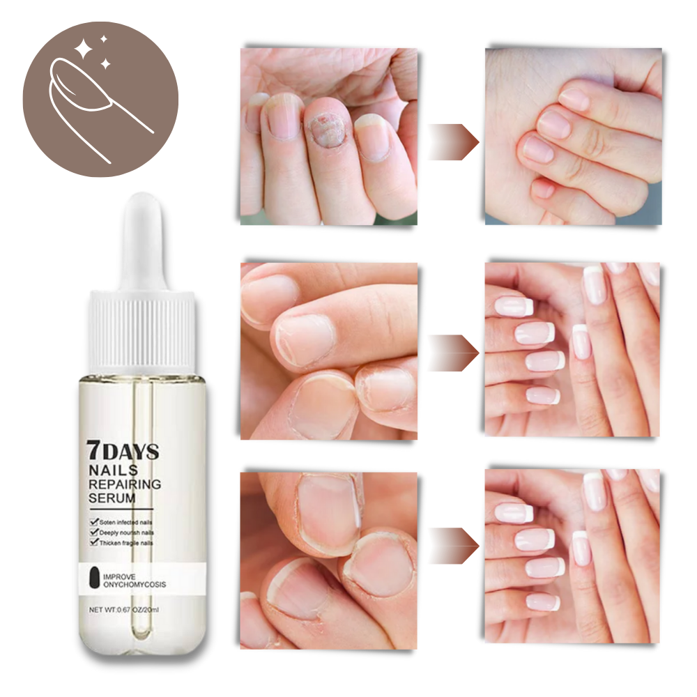 7 Days Nail Repair Essence - Orthorun