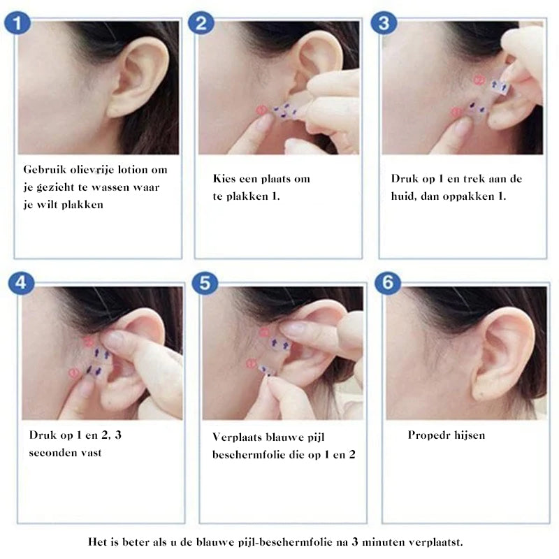 Orthorun | Invisible Face Lifter Tape – Instant Face Lift & V-Shape Slimming Tape