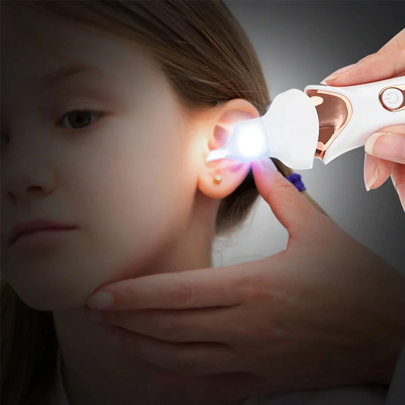 5 in 1 Electric Earwax Remover. - Orthorun