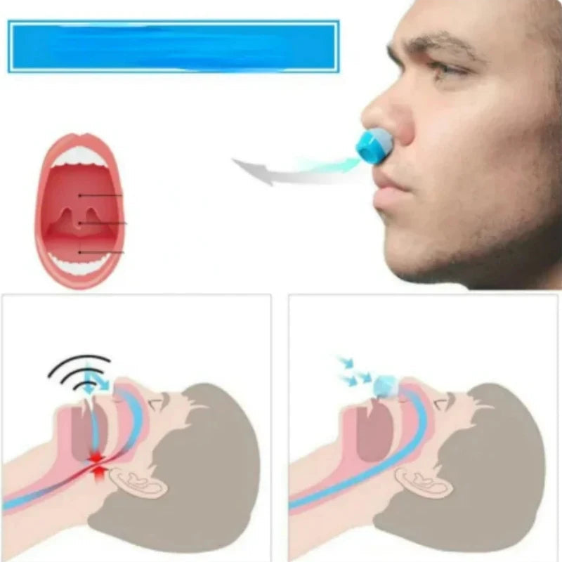 2-in-1 Anti Snore Device and Air Purifier Nose Clip - Orthorun