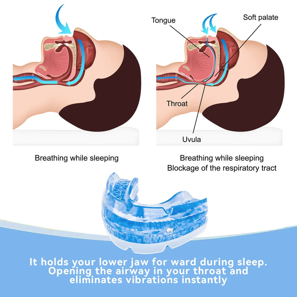 Adjustable Anti Snore Mouthpiece - Orthorun