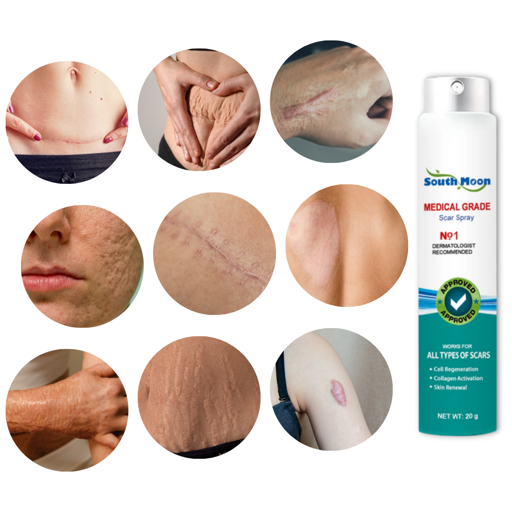 Orthorun | Spray Treatment for Scar Removal – Silicone Scar Healing Spray for Face & Body
