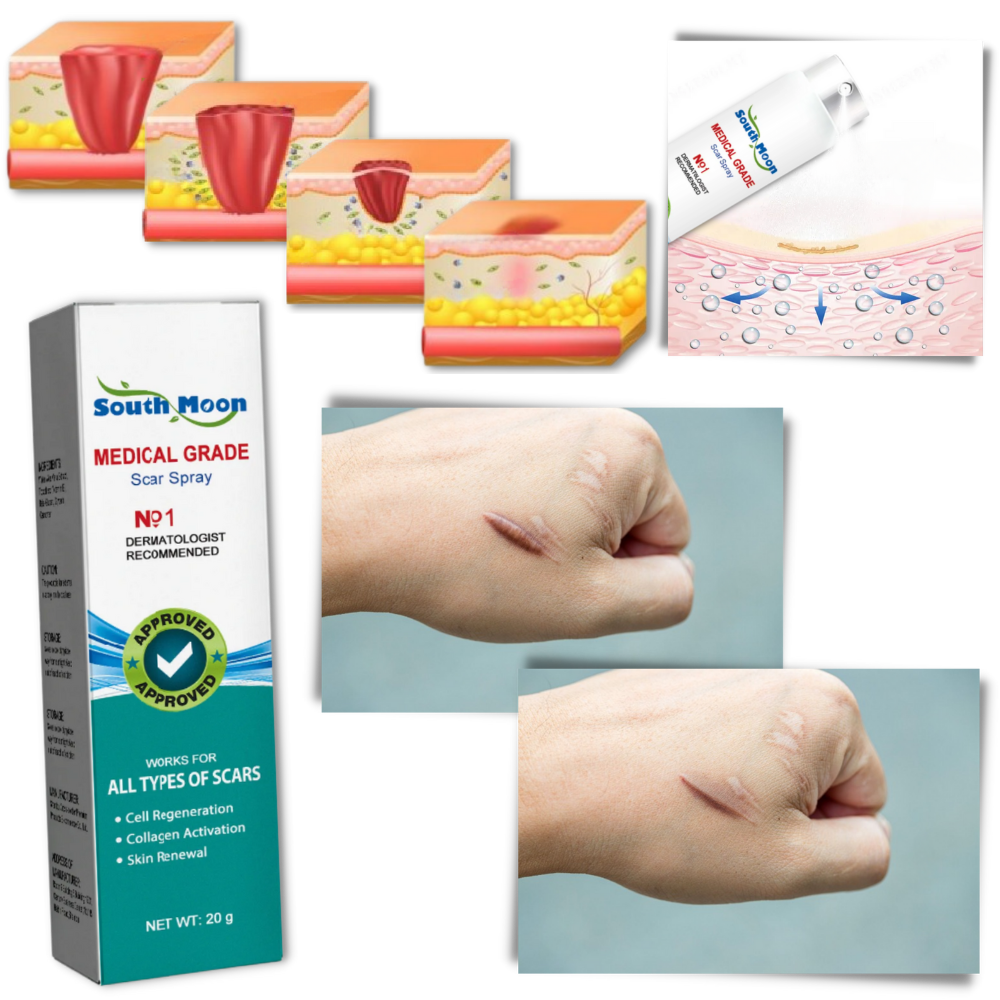 Orthorun | Spray Treatment for Scar Removal – Silicone Scar Healing Spray for Face & Body